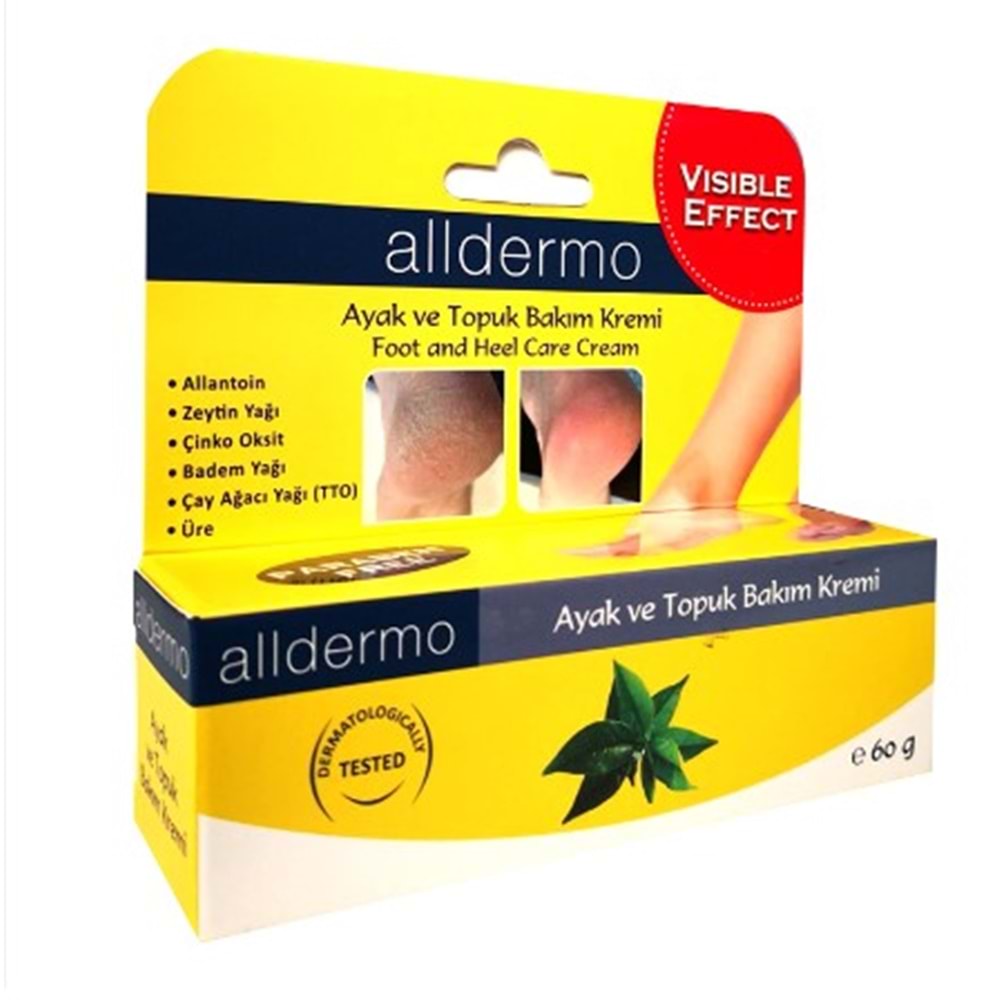 ALLDERMO AYAK BAKIM TOPUK ÇATLAK KREMİ 60 GR