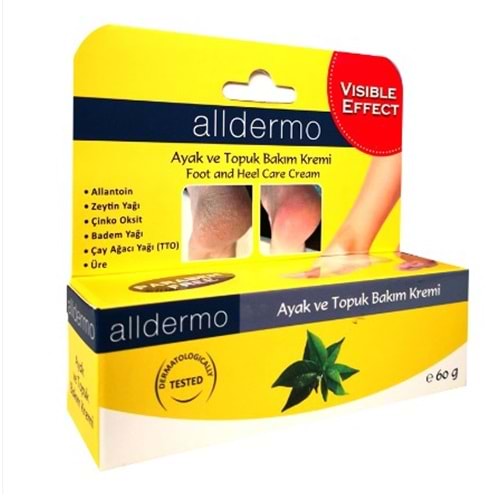 ALLDERMO AYAK BAKIM TOPUK ÇATLAK KREMİ 60 GR